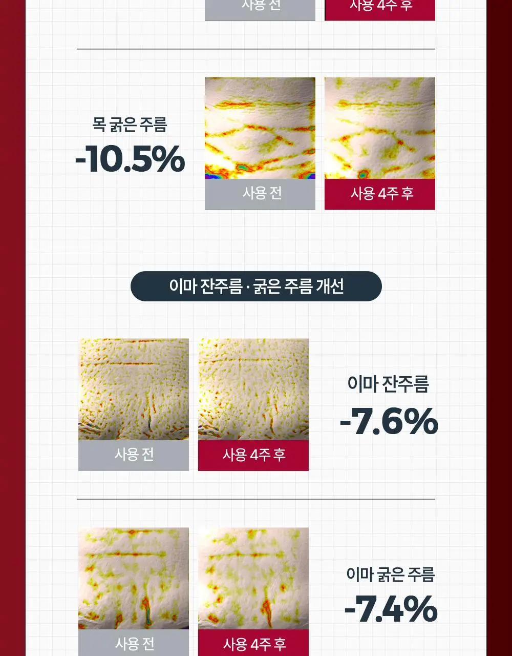 [6주모공세럼] 유세린 하이알루론 3X 컨센트레이트 5ml*6 상세페이지 12